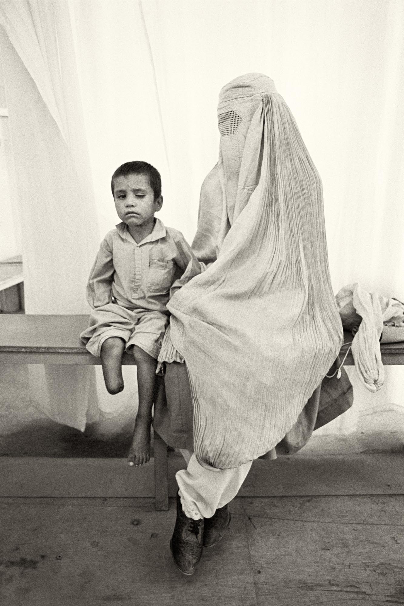 Sarwar, de seis años, perdió la pierna y un ojo en una explosión de una mina. Le acompaña su madre cubierta por la burka. Kabul (Afganistán), agosto de 1996.